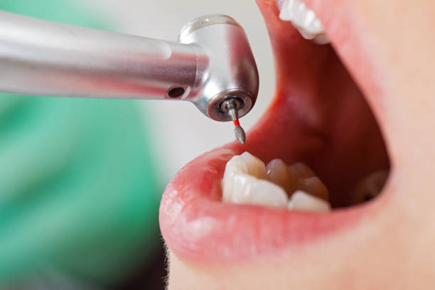 Best Pediatric Emergency Dentist in Boscobel, WI